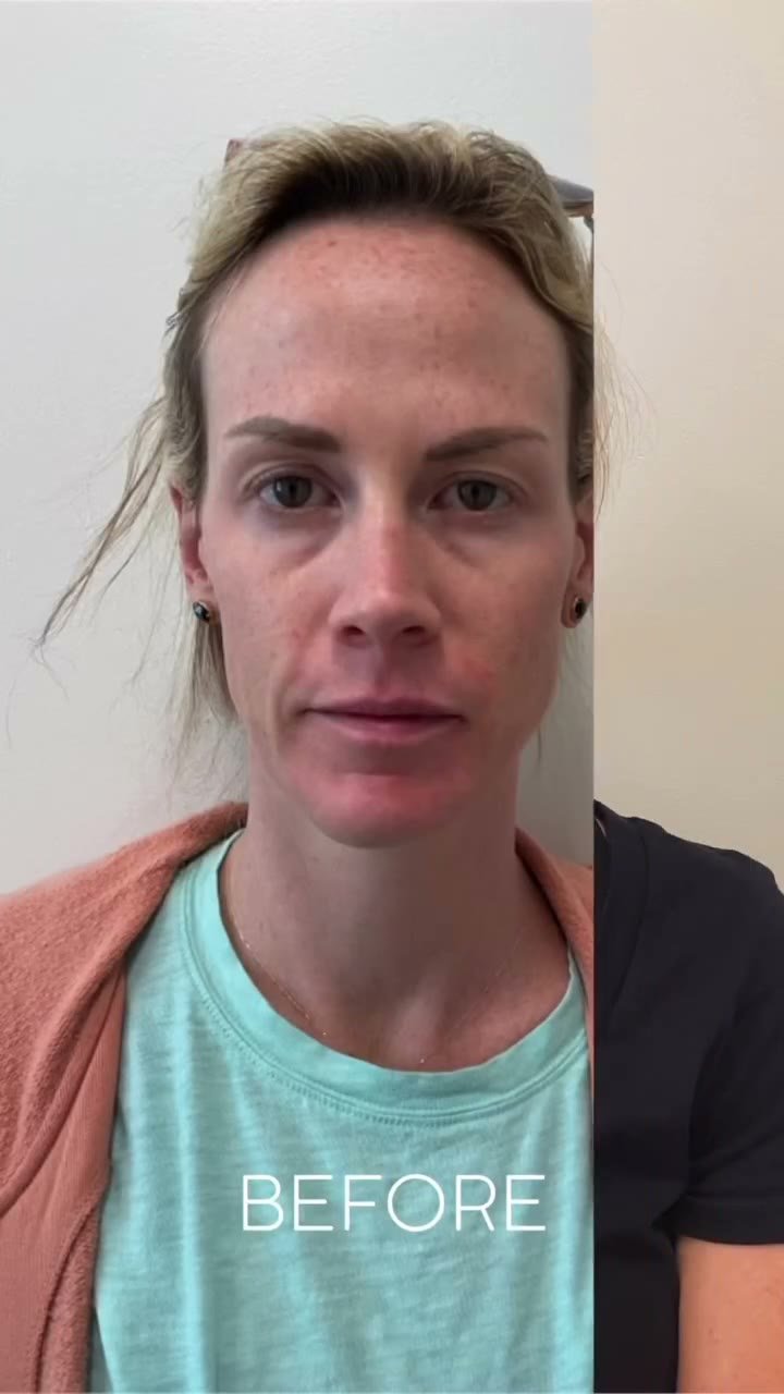 Treatment results reel